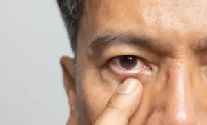 يحقق الادعاء العام للمرضى الذين يعانون من أعمى في مستشفى جيزا –