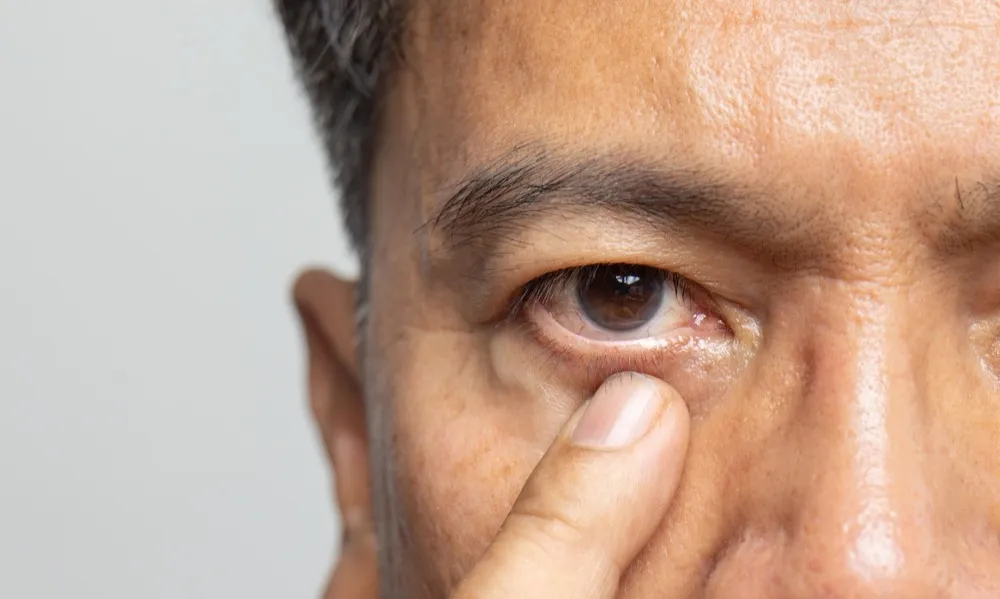 cataract surgery in Lancaster PA.jpg