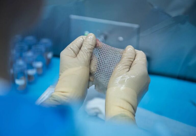 مقترح برلماني لـ “التبرع بأنسجة الجلد” يثير الجدل –