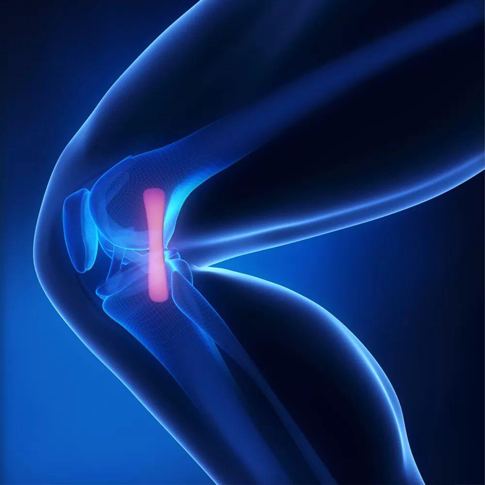 ACL and PCL Surgery mini1